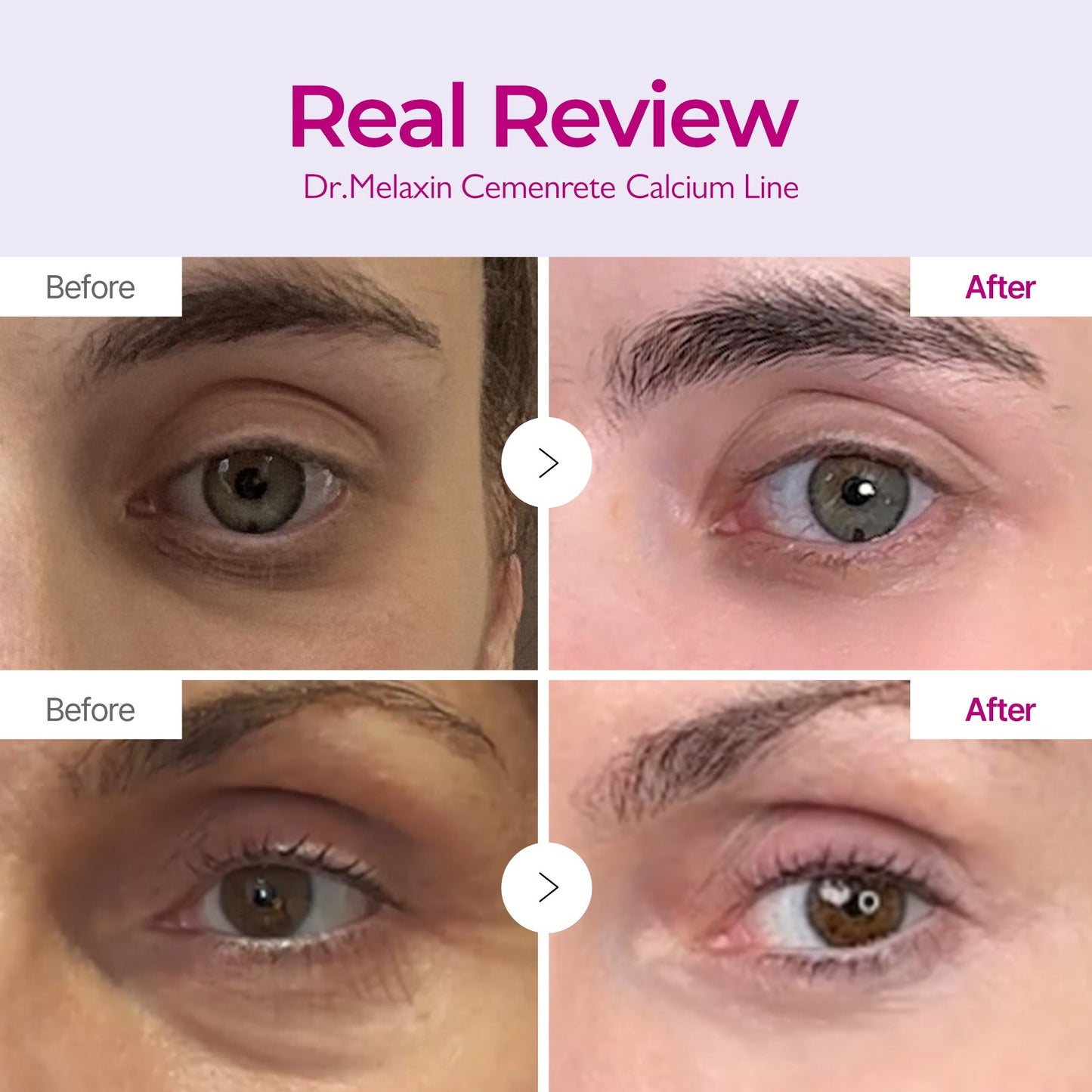 Cement Calcium Intense Ampoule