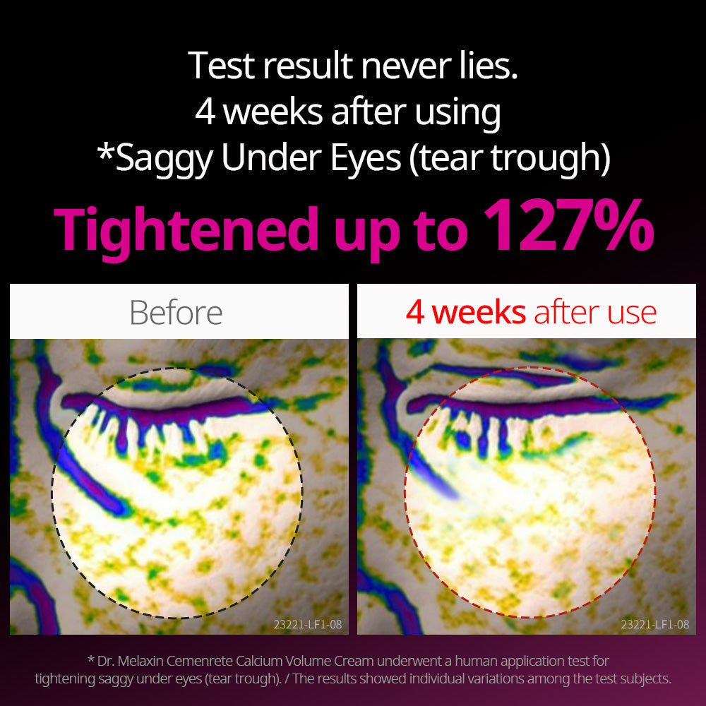 Cementrete Eye care Line