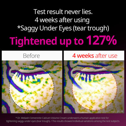 Cementrete Eye care Line