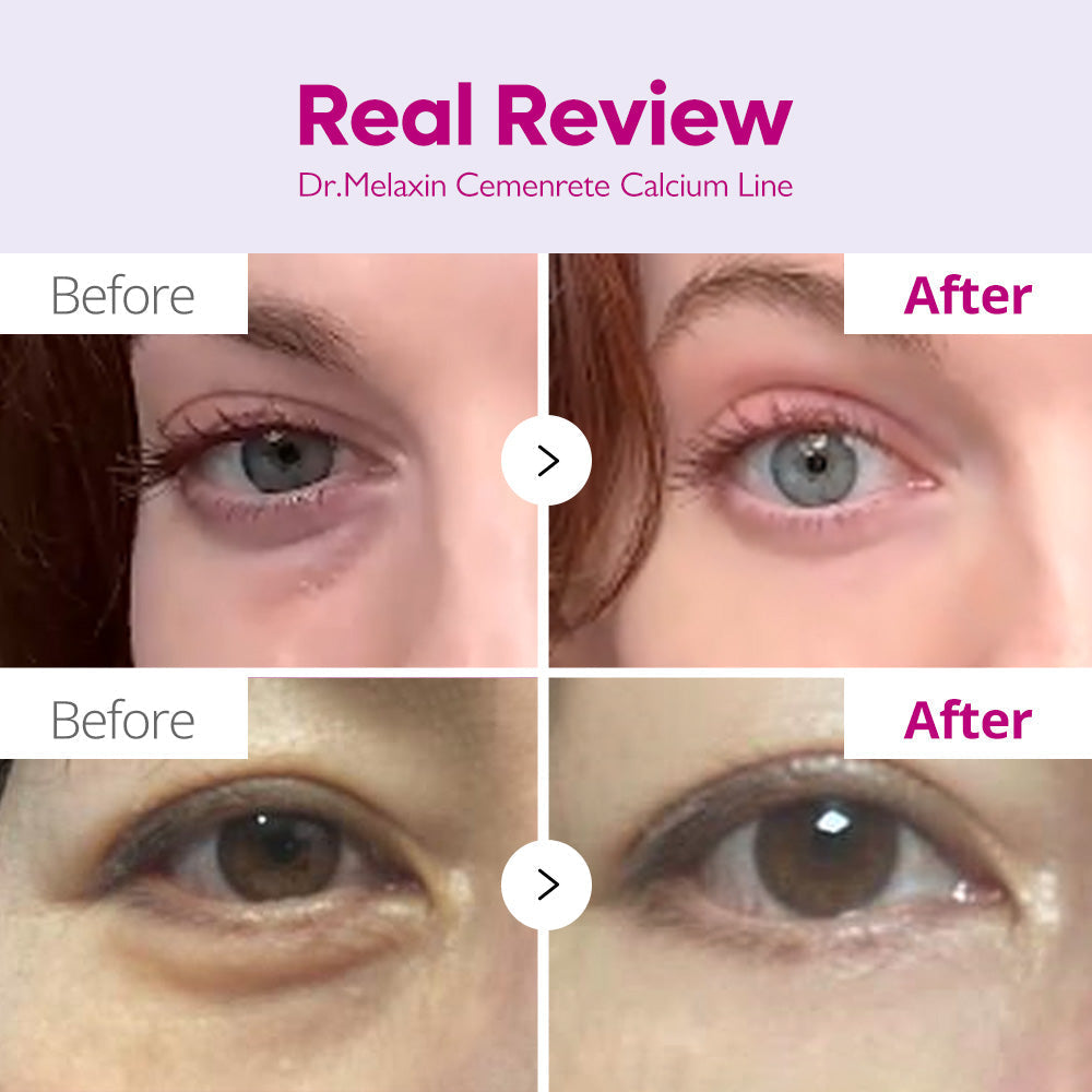 Cementrete Eye care Line