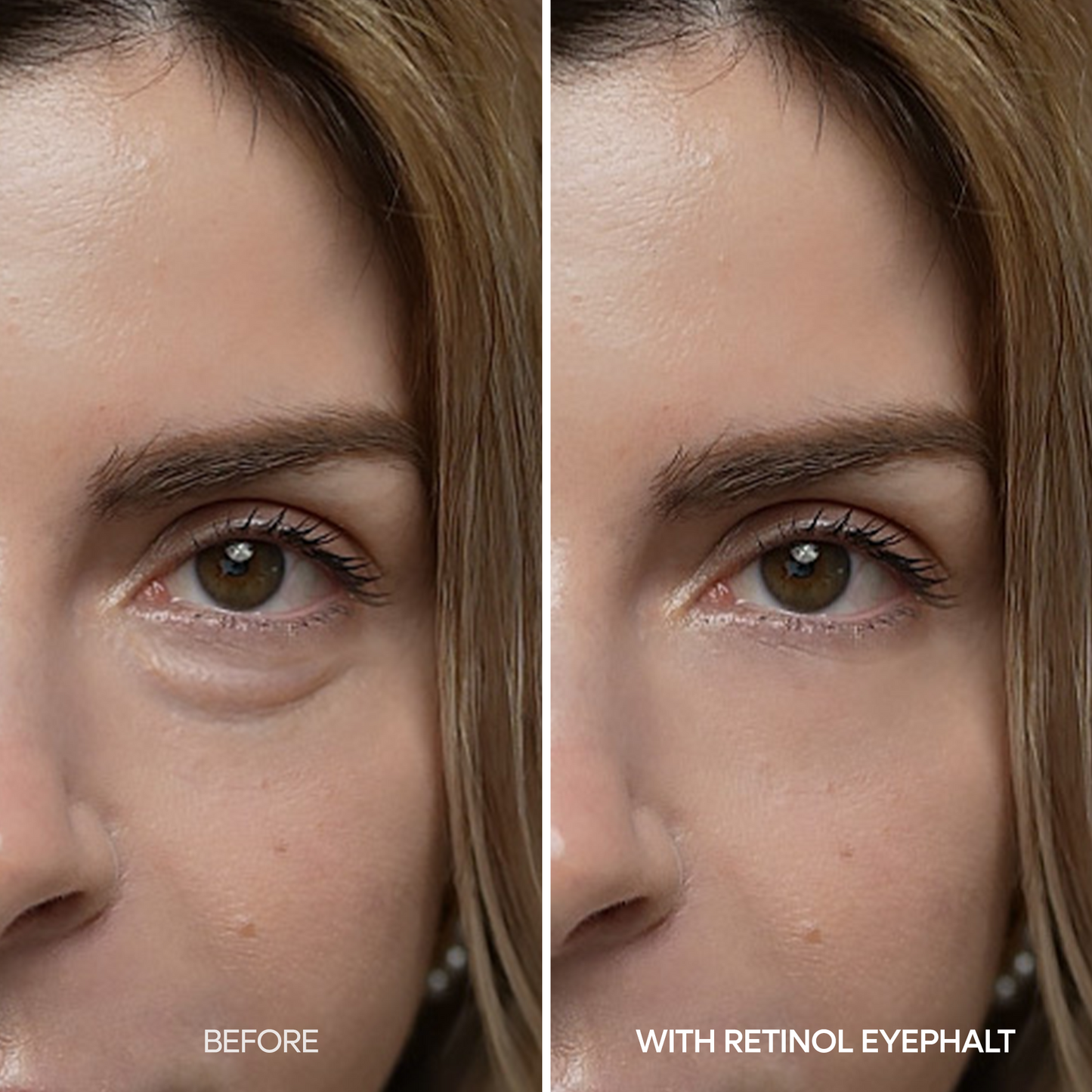 Retinol Eye Bag Cream