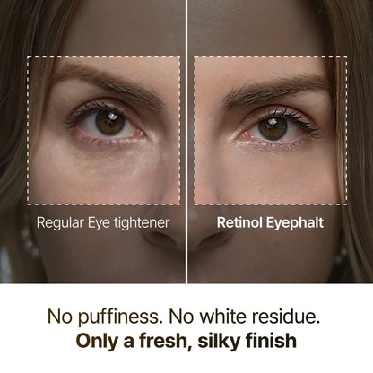 Retinol Eye Bag Cream