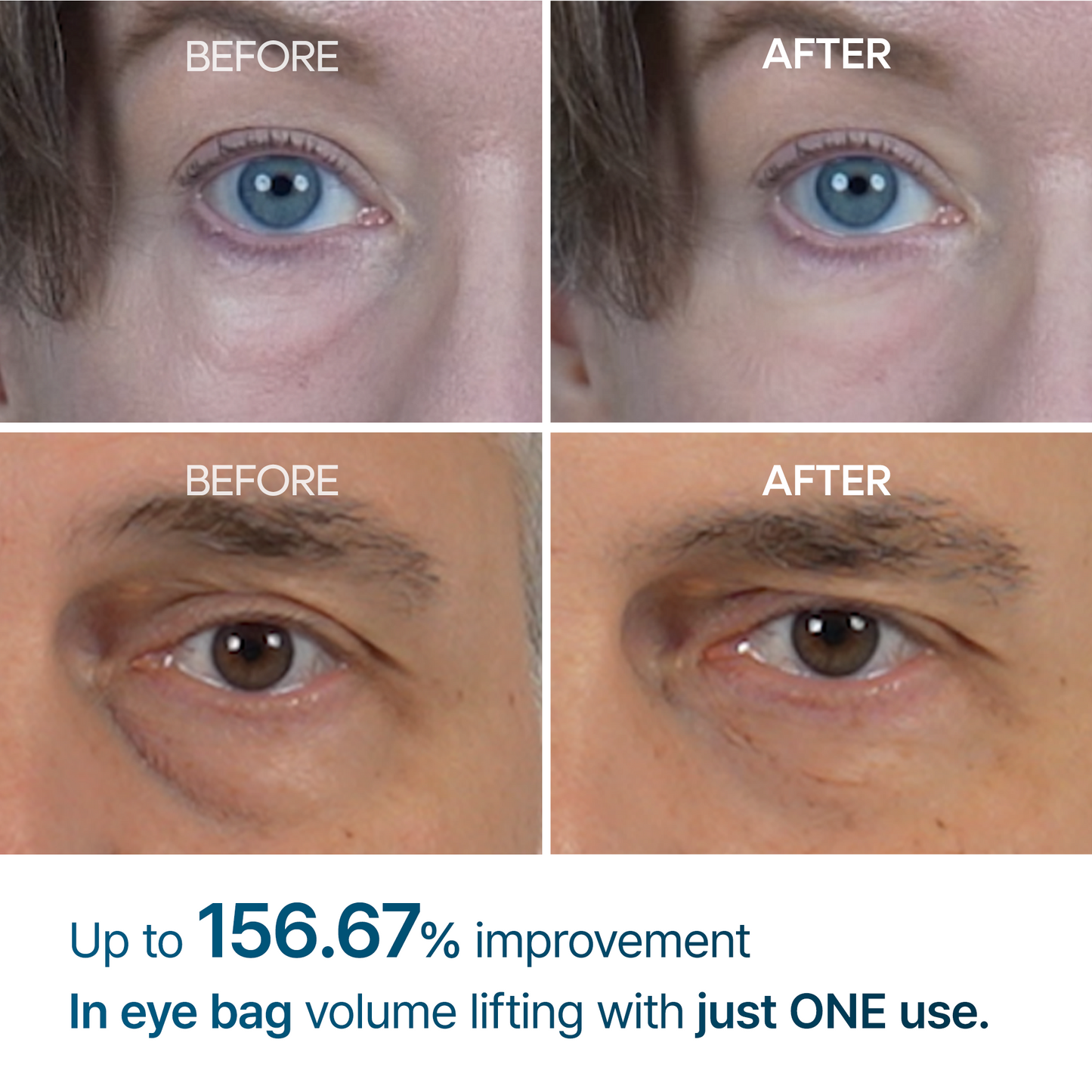 Eyephalt eye bag cream