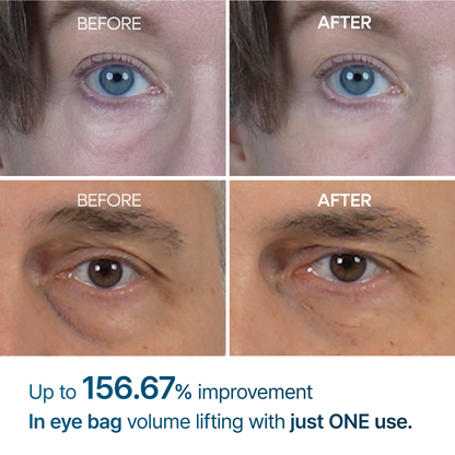 Eyephalt eye bag cream