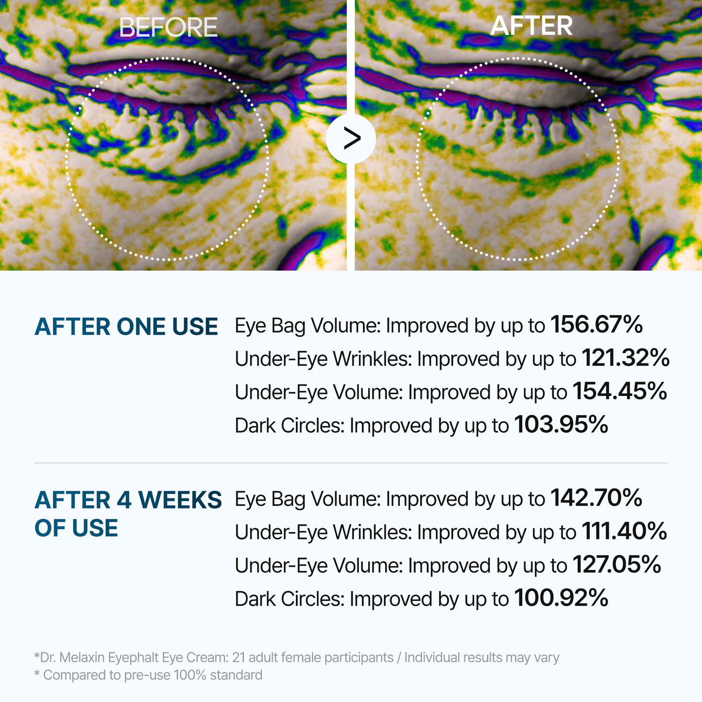 Eyephalt eye bag cream