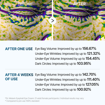 Eyephalt eye bag cream